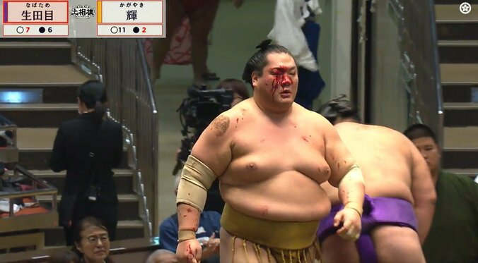 十両・輝、大流血のアクシデント 館内の歓声が一転、静寂とざわめき 自身初の各段優勝に向け痛い2敗目 嘉陽も敗れ星の差「１」でリード変わらず 4枚目