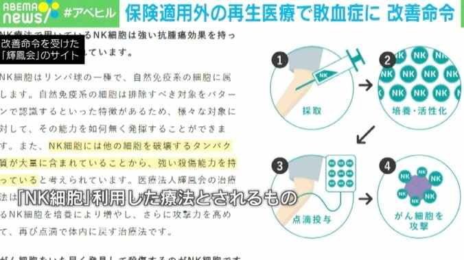 「NK細胞」を利用した療法とされるもの