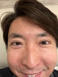有村昆『実は昨日、白内障の手術をしました。。』