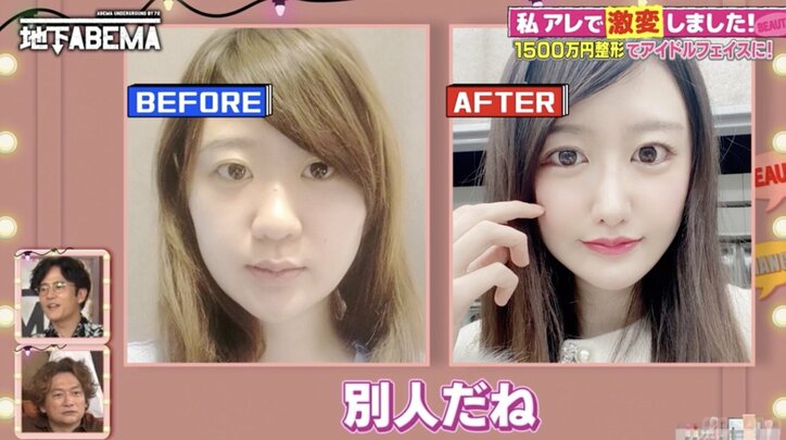 【写真・画像】草なぎ剛、“人中短縮”整形シミュレーションに興味津々「やろうかな」 2枚目