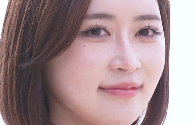 「全然違う！」整形総額1000万円の23歳美女のビフォーアフターに衝撃「綺麗な人やな」