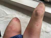 山田千紘『足がボロボロなもんでー。』