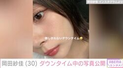 “役満ボディー”岡田紗佳、美容整形後ダウンタイム中の写真公開