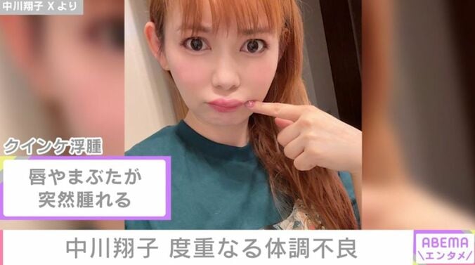 中川翔子