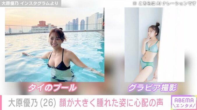 大原優乃（26）、顔が大きく腫れた姿に心配の声「大丈夫ですか？」「かなり痛そう」 3枚目