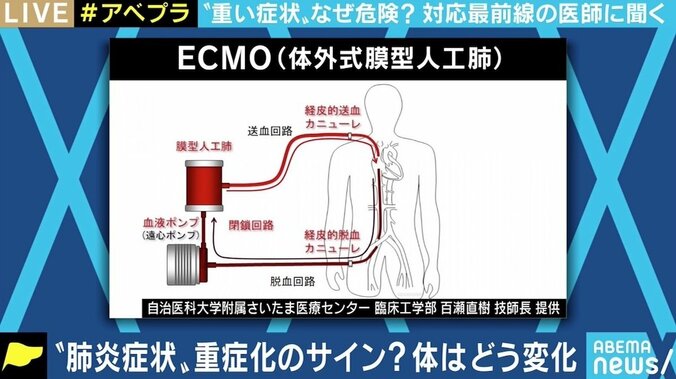 異なる重症者の定義 重症化因子が特定できていない背景も？ 最前線医師に聞く医療の現状と課題 10枚目