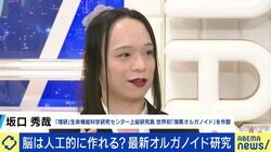 脳は人工的に作れる？ “意識や感情”を持つ可能性も？ 世界初「海馬オルガノイド」を作製した研究者に聞く