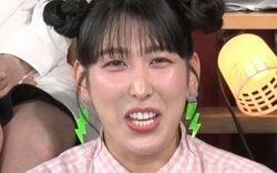 3時のヒロインゆめっち、整形ダウンタイム中の写真を公開し驚きの声「真っ赤だ！」