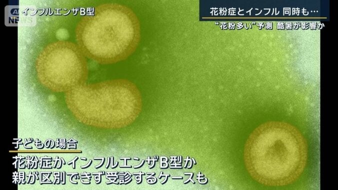 インフルエンザB型