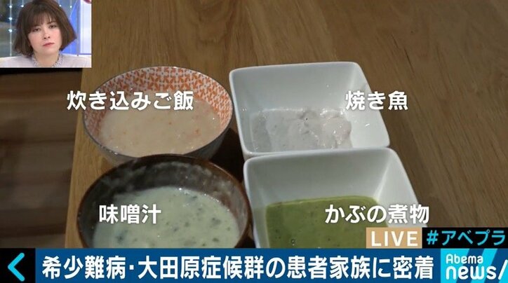日本に100人未満…希少難病「大田原症候群」患者母子に密着