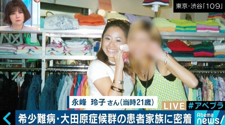 日本に100人未満…希少難病「大田原症候群」患者母子に密着