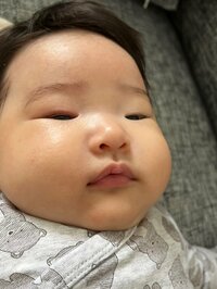 内山琴『湿疹で病院へ！！』