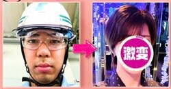整形費用330万円で激変！髙橋海人似ホストのビフォーアフターに衝撃「これは人生変わる」「整形顔っぽくない」