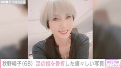 2023年に食道がん寛解・秋野暢子（68）、足の小指を骨折し痛々しい写真を公開「これは絶対痛い…」心配の声