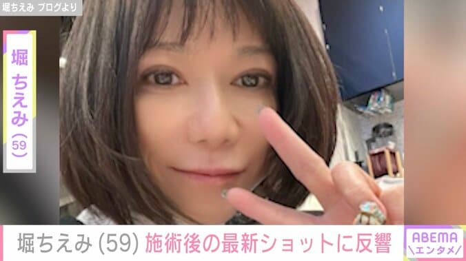 【写真・画像】堀ちえみ（59）、施術後の“ツルツル肌”際立つ最新ショットに「お肌が輝いてます」などの声　1枚目