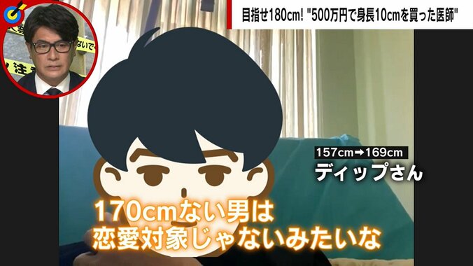 500万円で“身長10センチ”を買った男性「太もも、スネの骨を人工的に一回折って…」 驚きの手法も整形外科医「5カ月あれば運動能力を回復できる」 3枚目