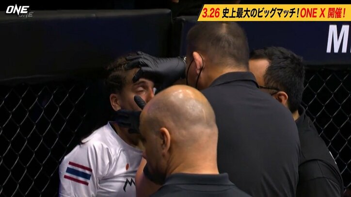 女子ムエタイ、あわや顔面破壊の衝撃TKO決着 “画面から消えた”敗者に「すごい音だった」「顔、大丈夫か」心配の声