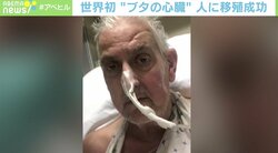 「ブタか人間か」境目が曖昧に？ 世界初の移植成功も…他の臓器への影響は