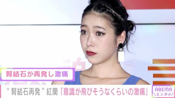 紅蘭、“腎結石”再発で意識が飛びそうなくらいの激痛に襲われたと報告「膀胱炎を甘く見ないで」と注意喚起 1枚目