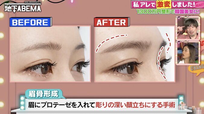 【写真・画像】整形総額1300万円の美女「中華美人に憧れてて」今後やりたい整形を明かす　2枚目