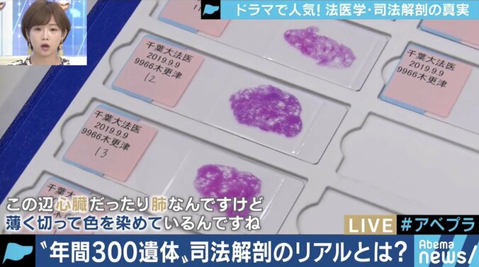 毎日解剖しても間に合わない…ドラマで人気も人手不足な「法医学者のリアル」 5枚目