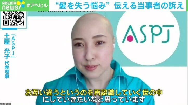 「髪がない=かわいそうではない 」30年隠してきた“抜毛症”当事者の訴え