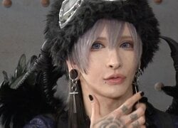 「整形総額2000万円」元引きこもりのバンドマン、整形手術の後遺症を告白「今でも下唇が痺れてる」「骨が飛び出しそう」