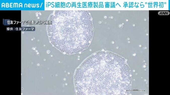 住友ファーマで培養したiPS細胞