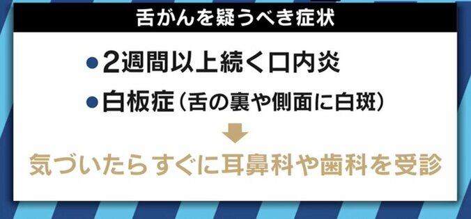 堀ちえみが「舌がん」告白…専門医「２週間以上続く口内炎は受診を」 3枚目