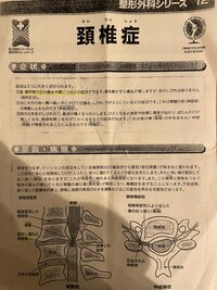 2700ツネの嫁『頚椎症…』