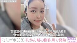 34歳で余命宣告を受けたミミポポ（38）、抗がん剤治療の副作用を報告「吐き気は2日目だけみたい」