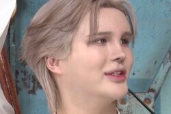 Matt、1番辛かった美容整形を告白「8倍くらい膨れあがっちゃった」手術内容に悲鳴