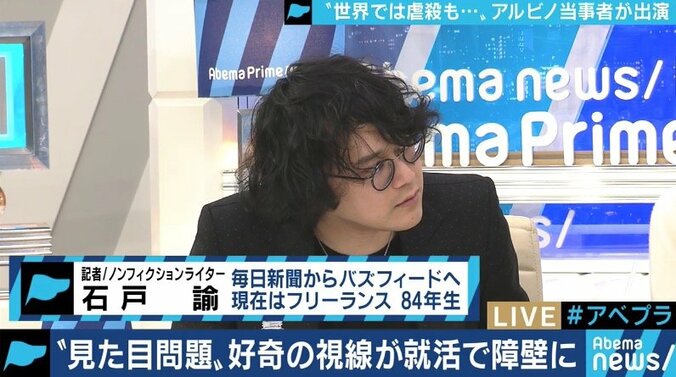 生まれつき色素が薄いアルビノ当事者の苦しみ「カラーコードに合わないから‥」バイト・就職を断られるケースも 8枚目