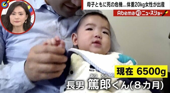 「生まれる可能性は99％ない」と宣告された“体重20kg”の女性が出産　夫婦で乗り越えた葛藤と母子生命の危機 5枚目