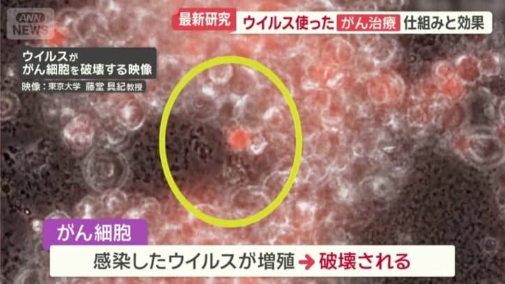 がん細胞は感染したウイルスの増殖が進むと丸くなる