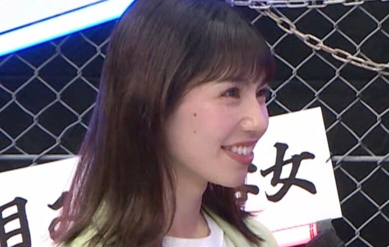 「おでこ少なすぎて可哀想」りなぴっぴ、後輩芸人に同情