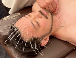流行りのルート治療、終わった後の顔面に衝撃「負けたボクサー」