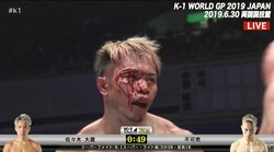 まるで“赤鬼”…大流血の不可思に魔裟斗「ゾーンに入った」　出血止まらず佐々木大蔵に無念のTKO負け