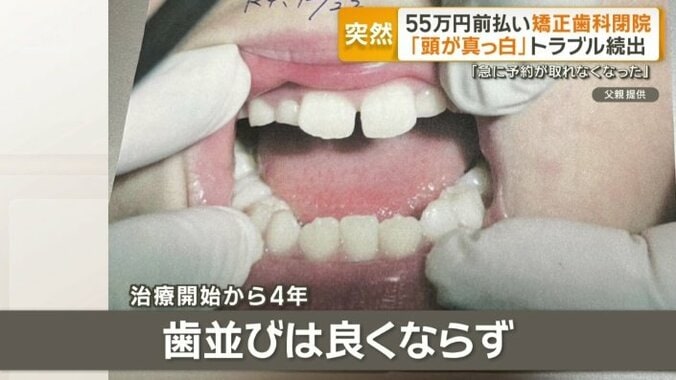 治療開始から4年経過も歯並びは良くならず