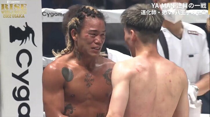 OFGマッチ、不運のアクシデントでドクターストップ 悔し涙の勝者に「いい試合だった」「視力に影響なければ」称賛と心配の声 