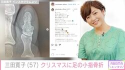 三田寛子、クリスマスに骨折 痛々しい姿に心配の声「1番痛いやつ！」
