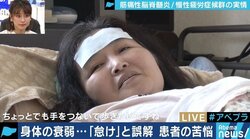 寝たきりで“怠け”の誤解も…叶うなら、孫と手を繋いで歩いてみたい 「筋痛性脳脊髄炎」の苦しみ