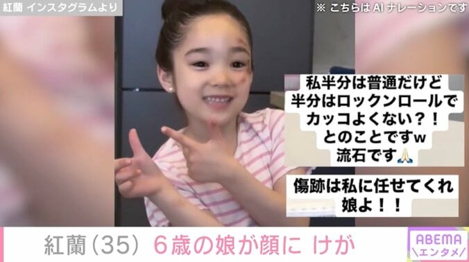 【写真・画像】草刈正雄(72)の長女・紅蘭(35) 6歳の娘が顔にけが「だいぶ派手に転んで帰ってきた」　2枚目