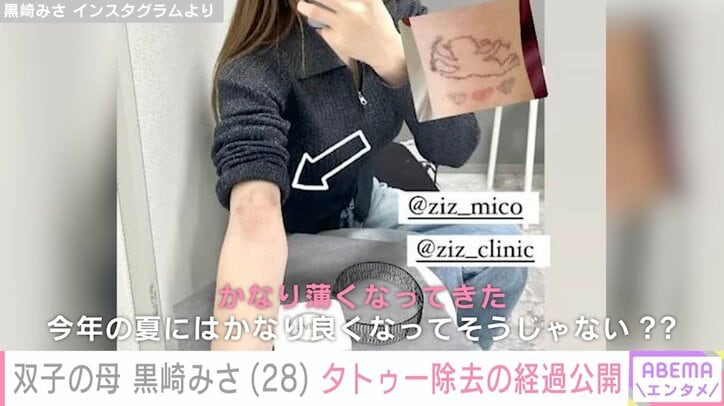 【写真・画像】「2000万かけて整形しなくてもよかった説」 黒崎みさが公開した幼少期と現在のビフォーアフターに驚きの声 2枚目