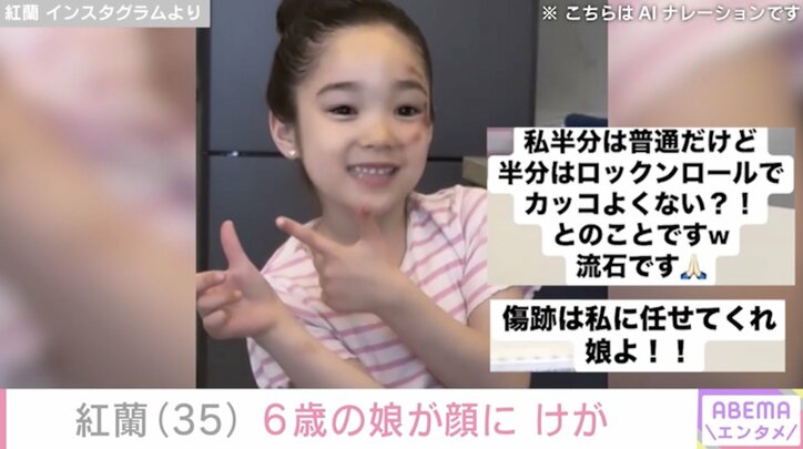 【写真・画像】草刈正雄(72)の長女・紅蘭(35) 6歳の娘が顔にけが「だいぶ派手に転んで帰ってきた」　2枚目