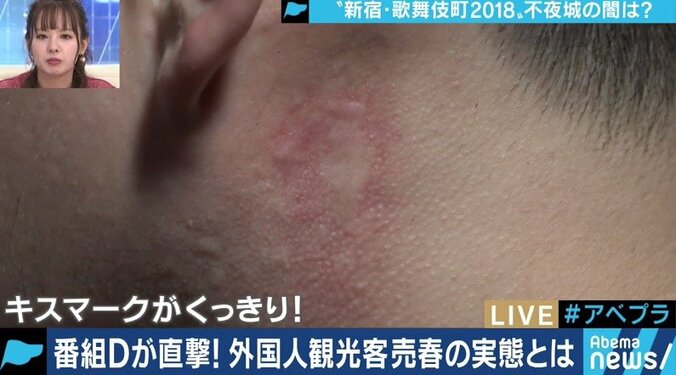 歌舞伎町の新たな闇　外国人観光客に紛れる売春婦を直撃取材 6枚目