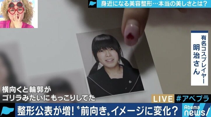 整形手術のイメージが変化、希望者が増加中？専門家「ゴールは美しい自分ではなく、明るい自分」