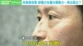 辞職・失職は不可避…兵庫県知事 再出馬の可能性は?今後のシナリオを専門家に聞く