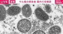 「サル痘」感染者を日本国内で初確認 東京都の30代男性と政府関係者