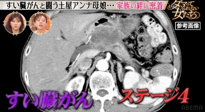 【写真・画像】土屋アンナの母、ステージ4のすい臓がんで1年前に1年半の余命宣告されていた「胃の不調から始まった」　2枚目